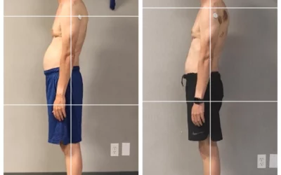 How Posture Affects the Pelvis | Postural Alignment Healing Plan Results